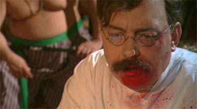 Filmbild: Hirschfeld operiert mit Blut im Gesicht